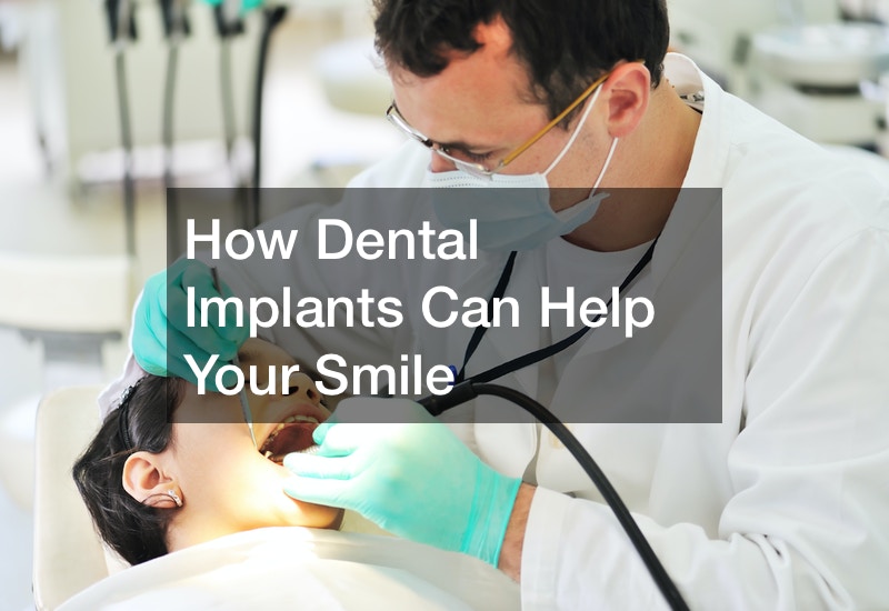 How Dental Implants Can Help Your Smile