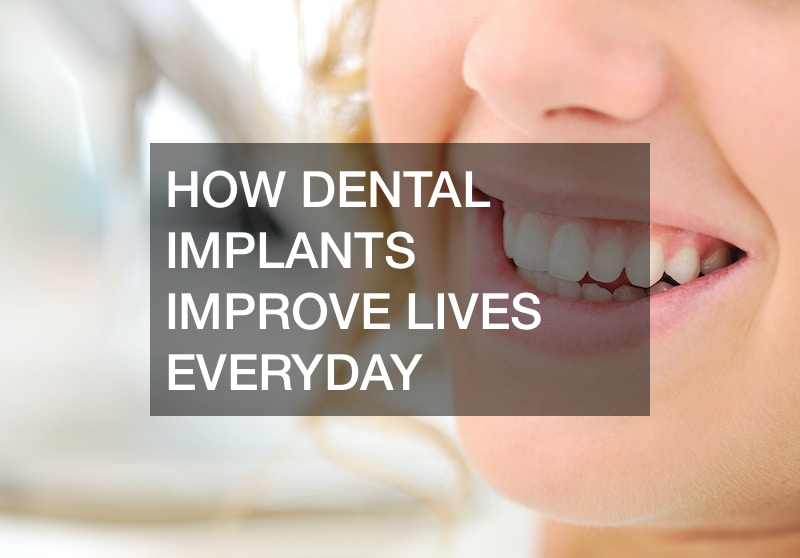 How Dental Implants Improve Lives Everyday